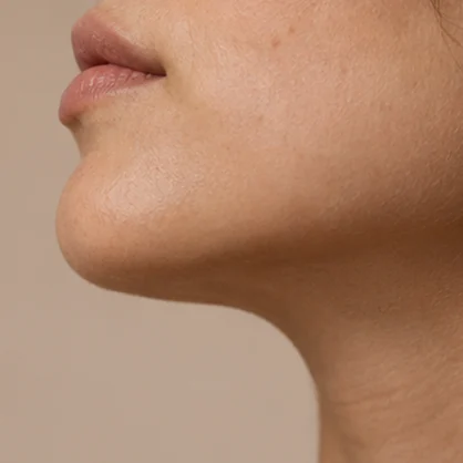 Side profile emphasizing a natural chin contour